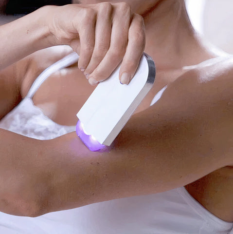 Ardo™ - Removal Kit Laser Touch Epilator